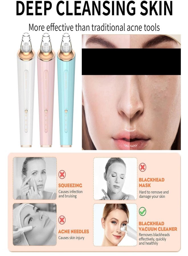 DIYthinker Blackhead Remover Pore Vacuum, Upgraded USB Rechargeable Facial Pore Cleaner Blackhead Removal Kit with 3 Suction Power,5 Probes Black Head Extractions Tool for Women & Men - Image 5
